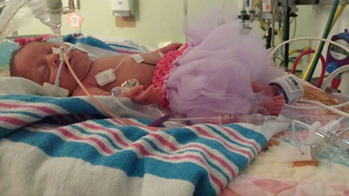 Little baby in the NICU