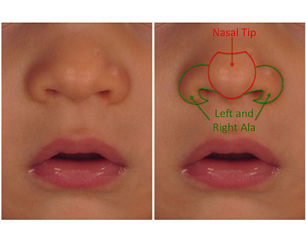 diagram of a child's nose