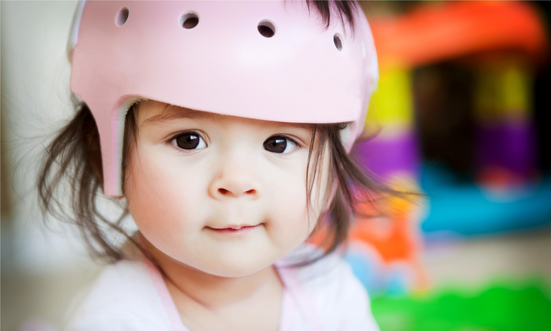 Infant girl with an orthopedic helmet smiles for the camera